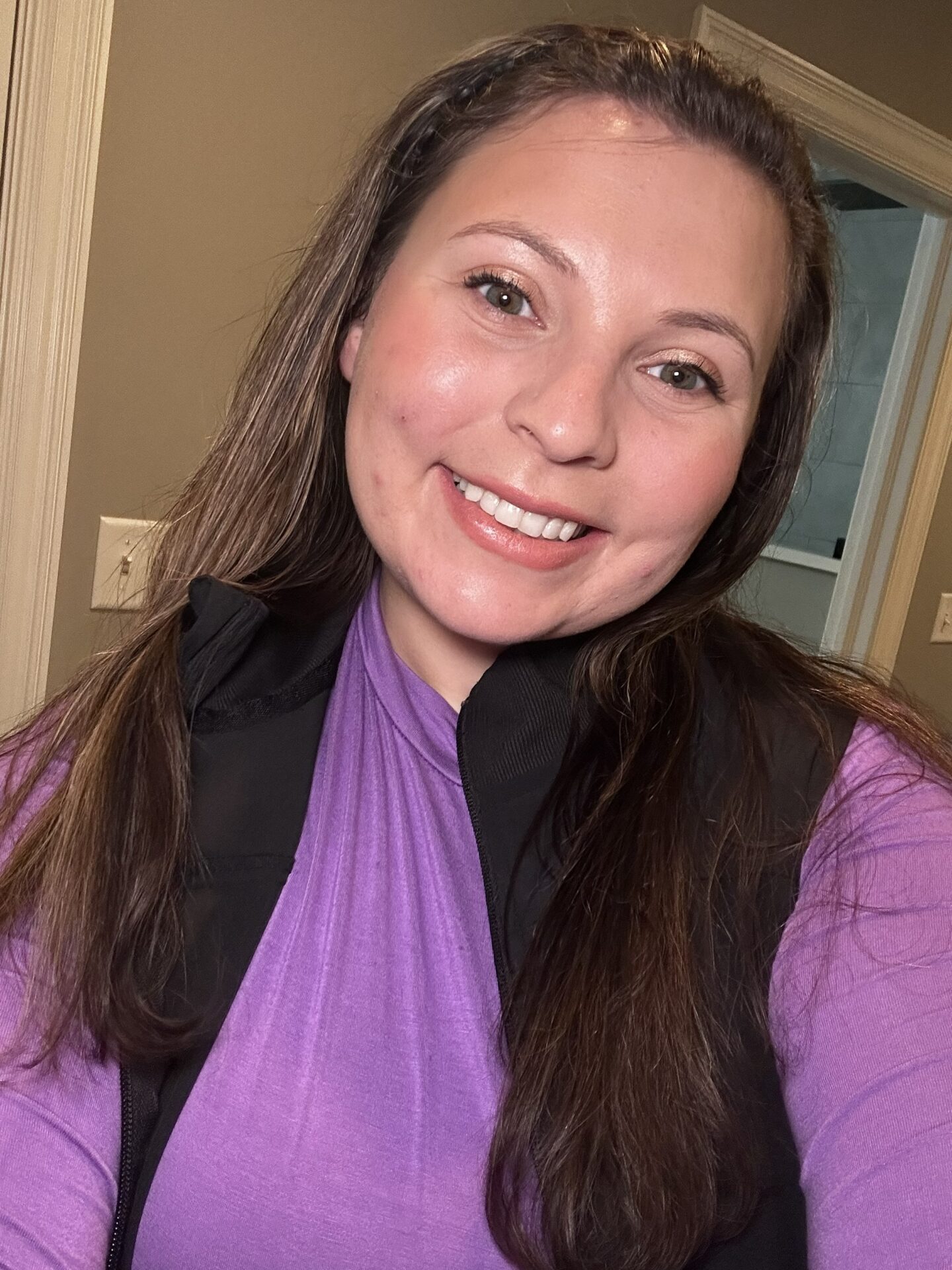 Alexis Likens nurse injector at Blondies Columbus IN